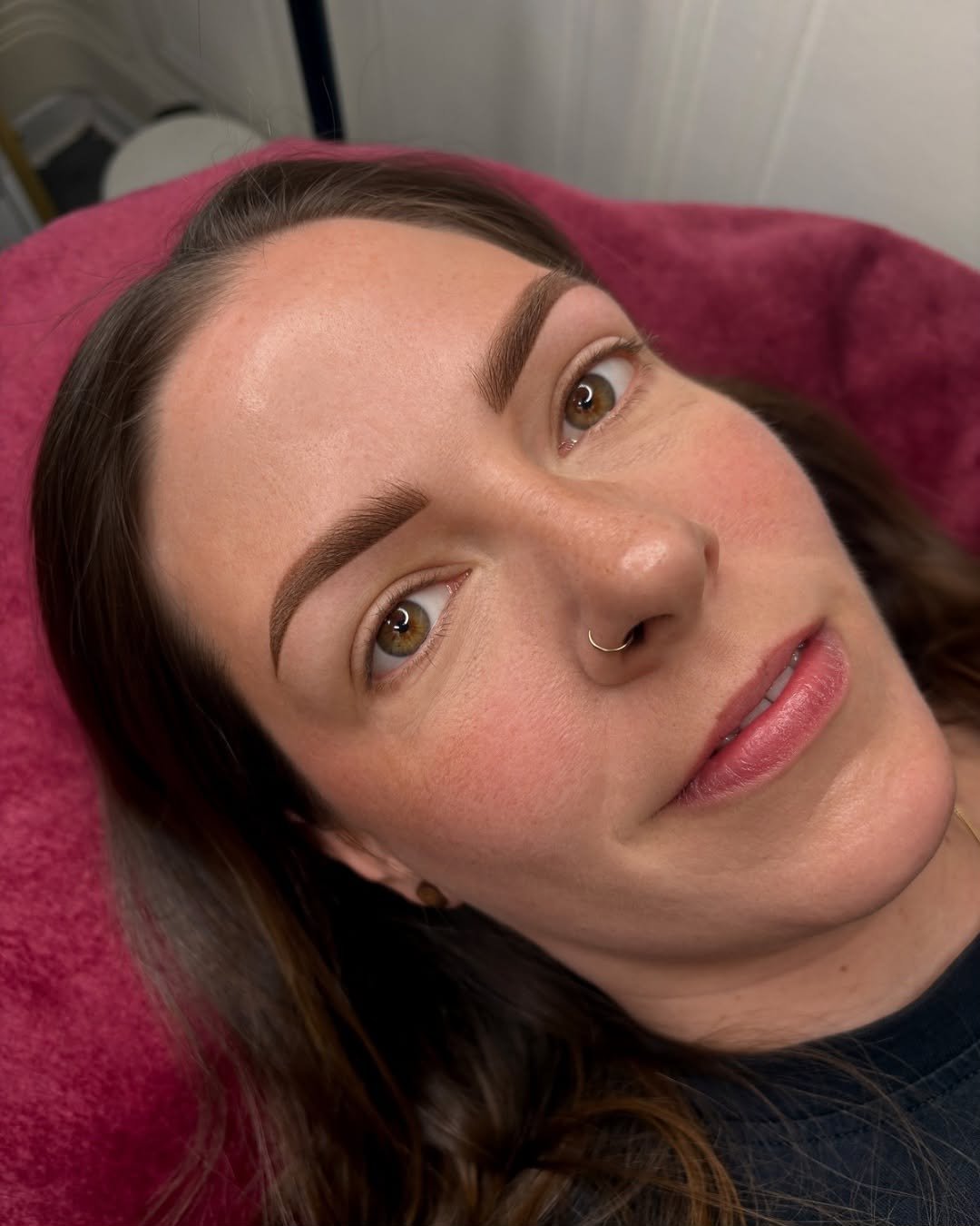 Browlifting